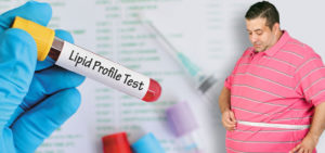 lipid profile test